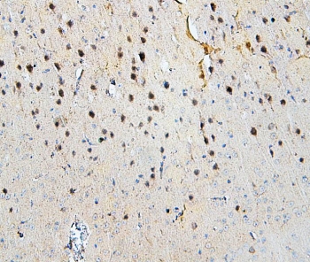 IHC staining of FFPE mouse brain with SKP1 antibody. HIER: boil tissue sections in pH6, 10mM citrate buffer, for 20 min and allow to cool before testing.