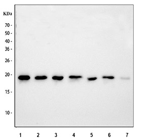 Western blot testing of human 1) T-47D, 2) Caco-2, 3) PC-3, 4) rat brain, 5) rat RH35, 6) mouse brain and 7) mouse RAW264.7 lysate with SKP1 antibody. Predicted molecular weight ~19 kDa.
