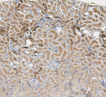 IHC staining of FFPE rat kidney with Gusb antibody. HIER: boil tissue sections in pH6, 10mM citrate buffer, for 20 min and allow to cool before testing.