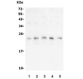 Western blot testing of human 1) HEK293, 2) K562, 3) Caco-2, 4) Raji and 5) A549 lysate with mtTFA antibody. Expected molecular weight: 24~29 kDa.