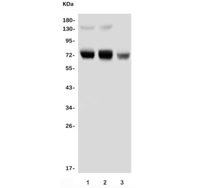Western blot testing of 1) human HL-60, 2) rat thymus and 3) mouse kidney lysate with PRMT5 antibody. Expected molecular weight ~72 kDa.
