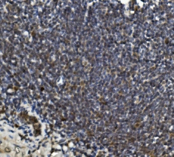 IHC staining of FFPE rat intestine with LRPPRC antibody. HIER: boil tissue sections in pH8 EDTA for 20 min and allow to cool before testing.
