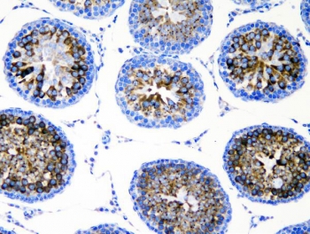 IHC staining of FFPE rat testis with DDX4 antibody. HIER: boil tissue sections in pH8 EDTA for 20 min and allow to cool before testing.