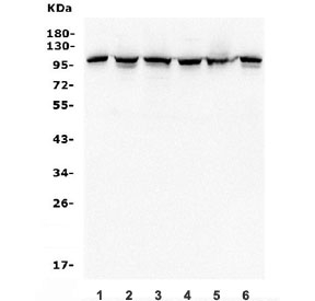 Western blot testing of human 1) HeLa, 2) HEK293, 3) U-2 OS, 4) U-87 MG, 5) rat PC-12 and 6) mouse NIH 3T3 lysate with Alpha 1 Catenin antibody. Predicted molecular weight ~102 kDa.
