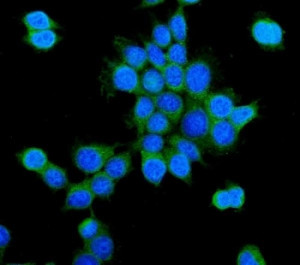 PCK2 Antibody MCF7 Breast Cancer Cell IF. PCK2 was detected in formalin-fixed, paraffin-embedded human MCF7 breast cancer cells following heat-induced epitope retrieval by steaming in citrate buffer, pH 6.0, for 20 minutes. Immunofluorescent staining shows PCK2 in green, while nuclei were counterstained with DAPI and appear blue. The observed signal is predominantly cytoplasmic and perinuclear, consistent with the mitochondrial localization of PCK2. PCK2 Antibody, a mitochondrial gluconeogenesis enzyme antibody, supports examination of PCK2 expression and subcellular distribution in breast cancer metabolism research.