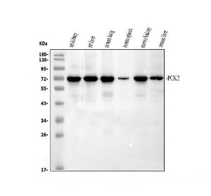 PCK2 Antibody Rat and Mouse Tissue WB. Western blot analysis was performed under reducing conditions using 30 ug of tissue lysate per lane. Lane 1: rat kidney; Lane 2: rat liver; Lane 3: mouse lung; Lane 4: mouse spleen; Lane 5: mouse kidney; Lane 6: mouse liver. The membrane was incubated overnight at 4Â°C with rabbit anti-PCK2 antibody at 0.5 ug/ml, followed by an HRP-conjugated secondary antibody and ECL detection. A specific band was observed at approximately 71 kDa in each sample, with variable expression intensity. PCK2 Antibody, a mitochondrial gluconeogenesis enzyme antibody, detects endogenous PCK2 across rat and mouse tissues.