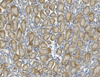 IHC staining of FFPE mouse kidney with PCK2 antibody. HIER: boil tissue sections in pH8 EDTA for 20 min and allow to cool before testing.