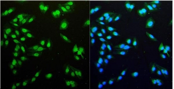 Immunofluorescent staining of FFPE human U-2 OS cells with NDC80 antibody (green) and DAPI nuclear stain (blue). HIER: steam section in pH6 citrate buffer for 20 min.