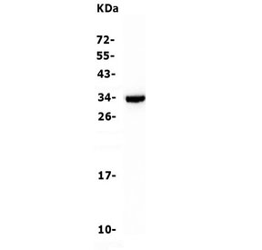 Western blot testing of human Raji cell lysate with CD79b antibody. Predicted molecular weight: 26~39 kDa.