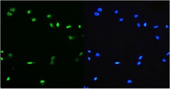 Immunofluorescent staining of FFPE human HeLa cells with PTBP1 antibody (green) and DAPI nuclear stain (blue). HIER: steam section in pH6 citrate buffer for 20 min.