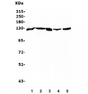 Western blot testing of human 1) HepG2, 2) Raji, 3) PC-3, 4) HeLa and 5) HEK293 lysate with RENT1 antibody. Predicted molecular weight ~124 kDa, but routinely observed at 130-140 kDa.