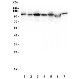 Western blot testing of human 1) HeLa, 2) HEK293, 3) U-87 MG, 4) K562, 5) A549, 6) rat PC-12 and 7) mouse NIH 3T3 lysate with HK1 antibody. Predicted molecular weight ~120 kDa.
