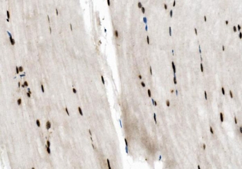 IHC staining of FFPE mouse skeletal muscle with NFIC antibody. HIER: boil tissue sections in pH8 EDTA for 20 min and allow to cool before testing.