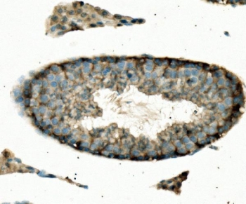 IHC staining of FFPE mouse testis with Enolase 1 antibody. HIER: boil tissue sections in pH8 EDTA for 20 min and allow to cool before testing.