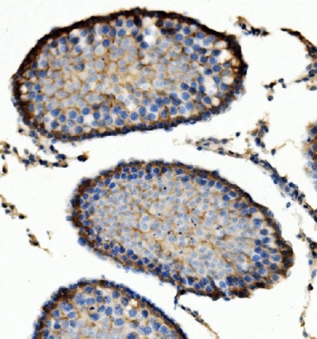 IHC staining of FFPE rat testis with Enolase 1 antibody. HIER: boil tissue sections in pH8 EDTA for 20 min and allow to cool before testing.