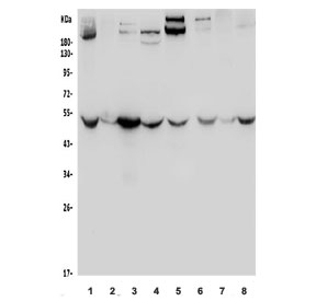 Western blot testing of rat 1) brain, 2) heart, 3) kidney, 4) liver, and mouse 5) brain, 6) kidney, 7) liver and 8) RAW264.7 lysate with Enolase 1 antibody. Predicted molecular weight ~47 kDa.