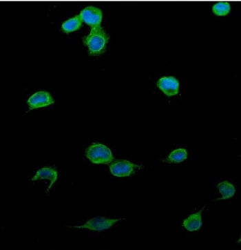 Immunofluorescent staining of FFPE human U-2 OS cells with Patched 2 antibody (green) and DAPI nuclear stain (blue). HIER: steam section in pH6 citrate buffer for 20 min.