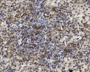 IHC staining of FFPE mouse spleen with U2AF65 antibody. HIER: boil tissue sections in pH8 EDTA for 20 min and allow to cool before testing.
