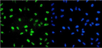 Immunofluorescent staining of FFPE human HeLa cells with U2AF65 antibody (green) and DAPI nuclear stain (blue). HIER: steam section in pH6 citrate buffer for 20 min.