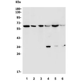 Western blot testing of 1) human HEK293, 2) human ThP-1, 3) human U-2 OS, 4) rat brain, 5) rat spleen and 6) mouse brain lysate with U2AF65 lysate. Expected molecular weight ~65 kDa.