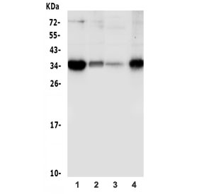 Western blot testing of human 1) PC-3, 2) HepG2, 3) K562 and 4) A375 lysate with Sprouty 4 antibody. Predicted molecular weight ~35 kDa.