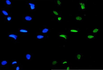 GATA3 Antibody HeLa IF. Immunofluorescence analysis of FFPE human HeLa cells stained with GATA3 Antibody / Multi-Application Research Antibody demonstrates prominent nuclear green fluorescence consistent with the localization of GATA binding protein 3 / GATA3 as a lineage-associated zinc finger transcription factor involved in epithelial differentiation and transcriptional regulation. DAPI nuclear counterstain is shown in blue. HIER: steam sections in pH 6 citrate buffer for 20 min.
