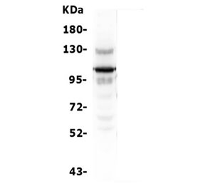 Western blot testing of human K562 lysate with USP15 antibody. Expected molecular weight ~112 kDa.