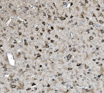 IHC staining of FFPE rat brain with GLS antibody. HIER: boil tissue sections in pH8 EDTA for 20 min and allow to cool before testing.