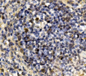 Irf3 Antibody Mouse Spleen IHC. Immunohistochemistry staining of FFPE mouse spleen with Irf3 antibody. HIER: boil tissue sections in pH8 EDTA for 20 min and allow to cool before testing.