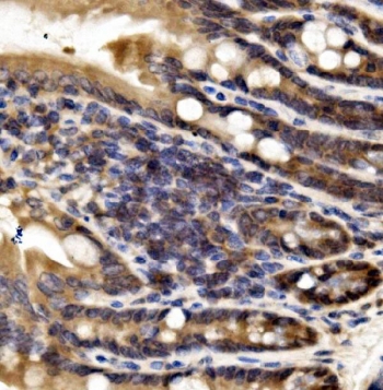 Irf3 Antibody Mouse Intestine IHC. Immunohistochemistry staining of FFPE mouse intestine with Irf3 antibody. HIER: boil tissue sections in pH8 EDTA for 20 min and allow to cool before testing.