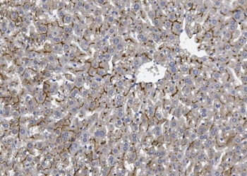 IHC staining of FFPE mouse liver with BCRP antibody. HIER: boil tissue sections in pH8 EDTA for 20 min and allow to cool before testing.