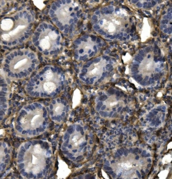 IHC staining of FFPE mouse intestine with AKAP12 antibody. HIER: boil tissue sections in pH8 EDTA for 20 min and allow to cool before testing.