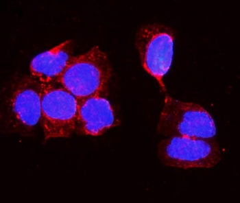 ALPL Antibody A431 Cell IF. Immunofluorescent staining of FFPE human A431 cells with ALPL antibody (red) and DAPI nuclear stain (blue). HIER: steam section in pH6 citrate buffer for 20 min.