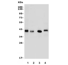 Western blot testing of 1) human HEK293, 2) human SW620, 3) rat kidney and 4) mouse kidney lysate with Arginase 2 antibody. Predicted molecular weight ~38 kDa.