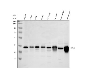 Arginase 2 Antibody Human, Mouse and Rat WB. Western blot analysis of ARG2 in human HepG2, K562, 293T and Caco-2 cells, rat kidney and colon tissues, and mouse kidney and colon tissues using Arginase 2 Antibody. Samples (30 ug/lane) were separated by 10% SDS-PAGE under reducing conditions and transferred to nitrocellulose. Lanes 1-8: HepG2, K562, 293T, Caco-2, rat kidney, rat colon, mouse kidney and mouse colon, respectively. The membrane was incubated with the antibody at 0.5 ug/ml overnight at 4Â°C, followed by HRP-conjugated secondary antibody and ECL detection. A specific band was detected at approximately 39 kDa, consistent with the expected molecular weight of ARG2. This Arginase 2 Antibody, also called Mitochondrial Arginase Antibody, detects ARG2 across human, mouse and rat samples for studies of mitochondrial arginine metabolism.