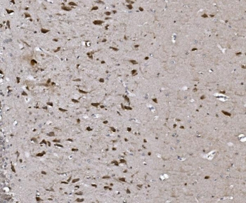 IHC staining of FFPE rat brain with NAF-1 antibody. HIER: boil tissue sections in pH8 EDTA for 20 min and allow to cool before testing.