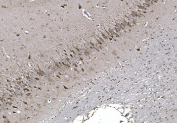 IHC staining of FFPE rat brain with NAF-1 antibody. HIER: boil tissue sections in pH8 EDTA for 20 min and allow to cool before testing.