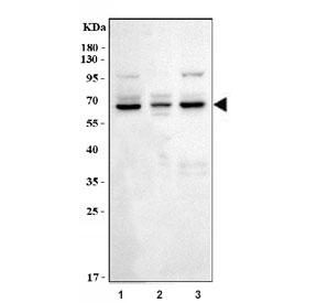 Western blot testing of human 1) HCCT, 2) HepG2 and 3) HL-60 cell lysate with CYP7A1 antibody. Predicted molecular weight ~54 kDa.