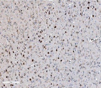 IHC staining of FFPE rat brain with EIF2B1 antibody. HIER: boil tissue sections in pH8 EDTA for 20 min and allow to cool before testing.