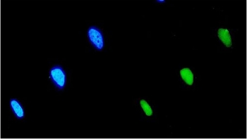 Immunofluorescent staining of FFPE human HeLa cells with EIF2B1 antibody (green) and DAPI nuclear stain (blue). HIER: steam section in pH6 citrate buffer for 20 min.