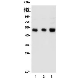 Western blot testing of human 1) HeLa, 2) MCF7 and 3) HEK293 lysate with Galactosidase alpha antibody. Predicted molecular weight ~48 kDa.