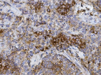 IHC staining of FFPE rat spleen with GRB10 antibody. HIER: boil tissue sections in pH8 EDTA for 20 min and allow to cool before testing.