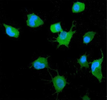 GRB14 Antibody Human A549 Cell IF. Immunofluorescent staining of FFPE human A549 cells with GRB14 antibody (green) and DAPI nuclear stain (blue). HIER: steam section in pH6 citrate buffer for 20 min.