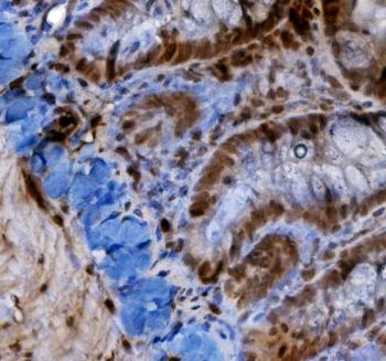 IHC staining of FFPE rat intestine with HIF1A antibody. HIER: boil tissue sections in pH8 EDTA for 20 min and allow to cool before testing.