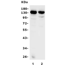 Western blot testing of human 1) A549 and 2) A431 cell lysate with ITGAV antibody. Expected molecular weight: 116-150 kDa.
