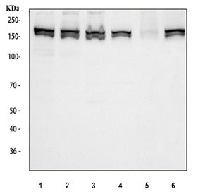 Western blot testing of 1) human K562, 2) human HeLa, 3) human 293T, 4) human HepG2, 5) rat RH35 and 6) mouse NIH 3T3 cell lysate with MSH6 antibody. Expected molecular weight: 120-160 kDa depending on phosphorylation level.