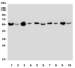 Western blot testing of 1) human HeLa, 2) human HEK293, 3) monkey heart, 4) human placenta, 5) rat heart, 6) rat brain, 7) rat kidney, 8) mouse heart, 9) mouse kidney and 10) mouse ANA-1 lysate with OXCT1 antibody. Predicted molecular weight ~56 kDa. 