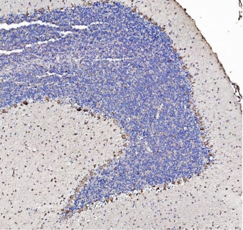 IHC staining of FFPE rat brain tissue with SHANK3 antibody. HIER: boil tissue sections in pH8 EDTA for 20 min and allow to cool before testing.