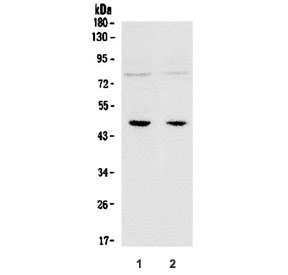 Western blot testing of 1) rat brain and 2) mouse brain with SOX-3 antibody. Predicted molecular weight ~45 kDa.