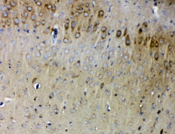 IHC staining of FFPE mouse brain with SYNPO antibody. HIER: boil tissue sections in pH8 EDTA for 20 min and allow to cool before testing.